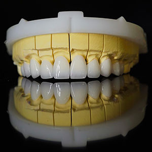 orodent 1x1 1
