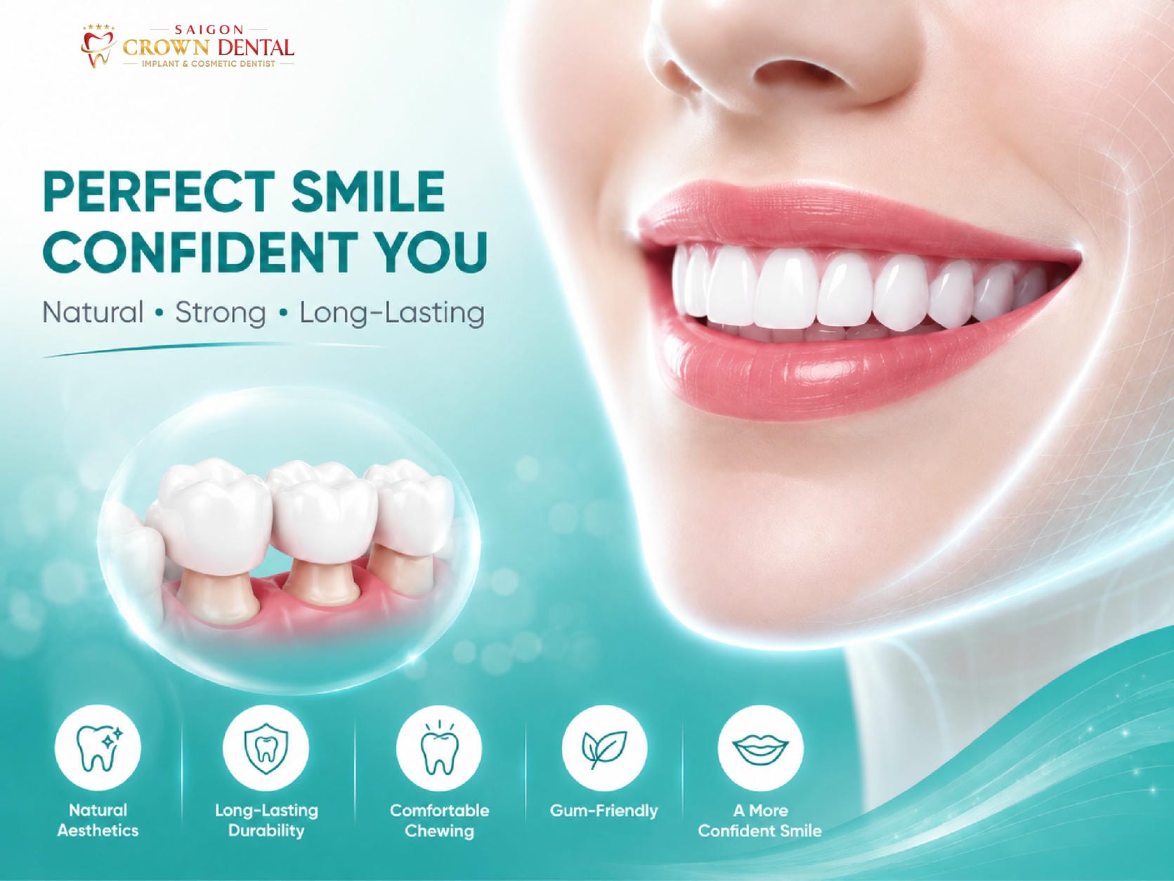 Hoàn thiện nụ cười mới