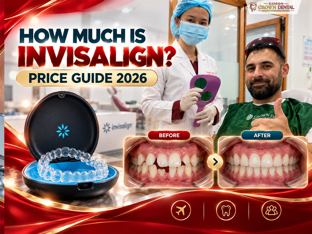 How much is invisalign