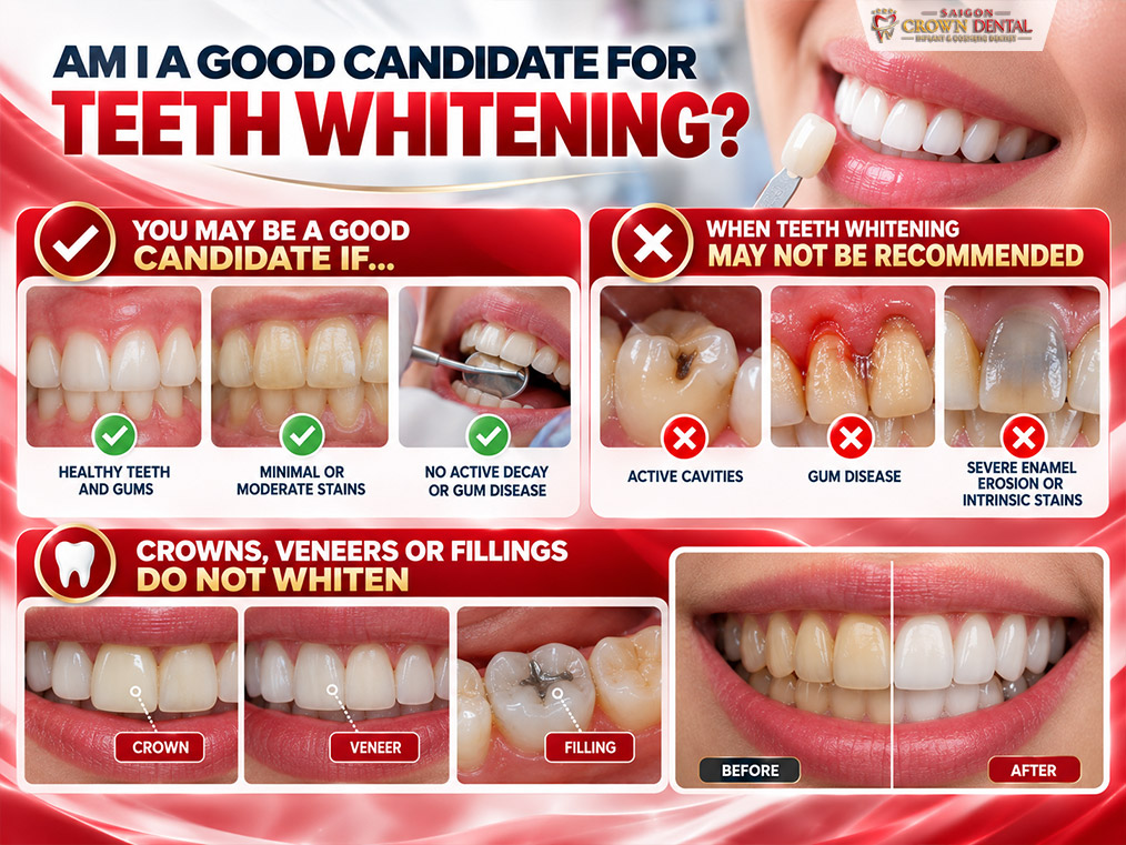 teeth whitening candidate