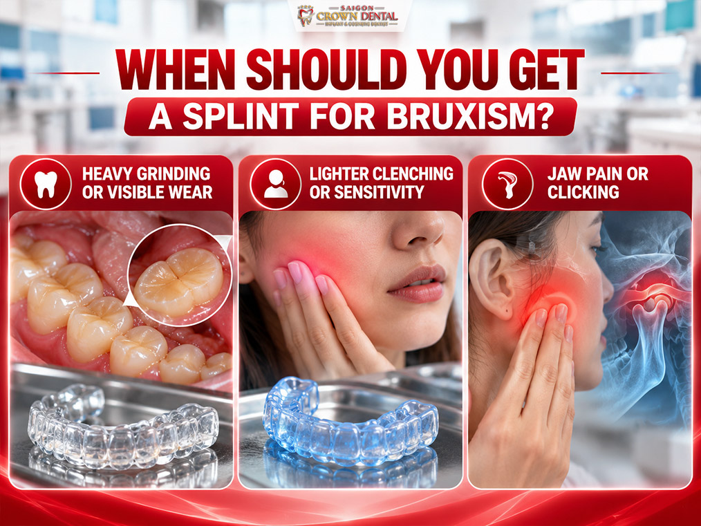splint for bruxism signs