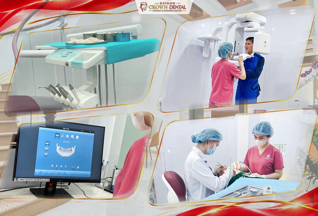 Chụp CT 3D