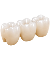 Cầu răng sứ