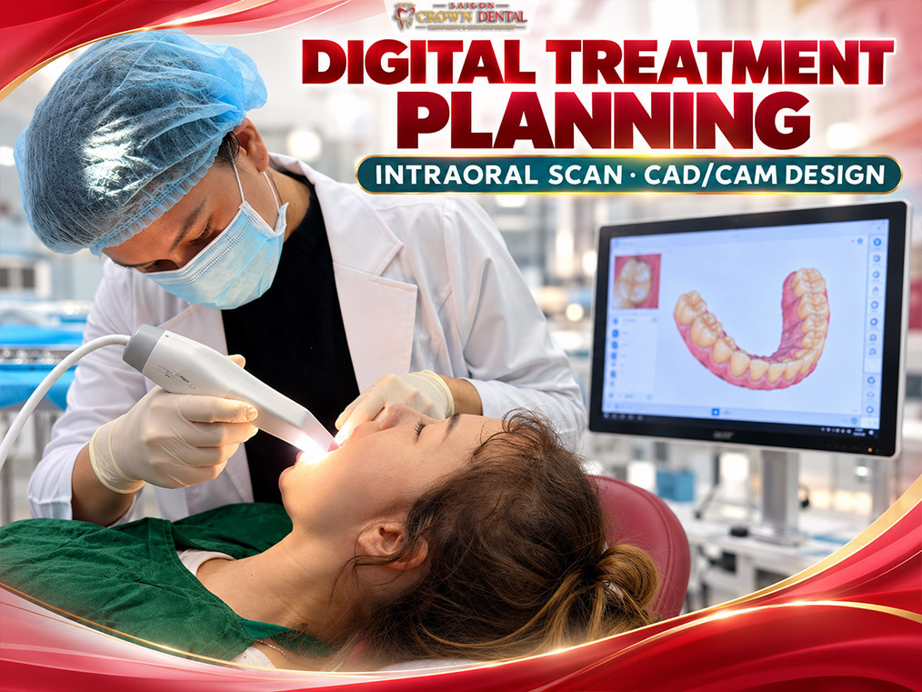 Intraoral Scan