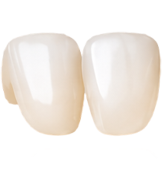 Mặt dán sứ veneer
