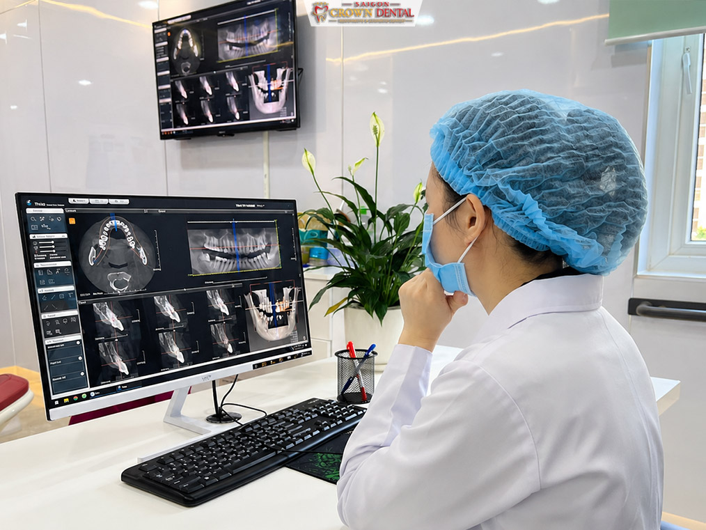 CBCT Scan Review