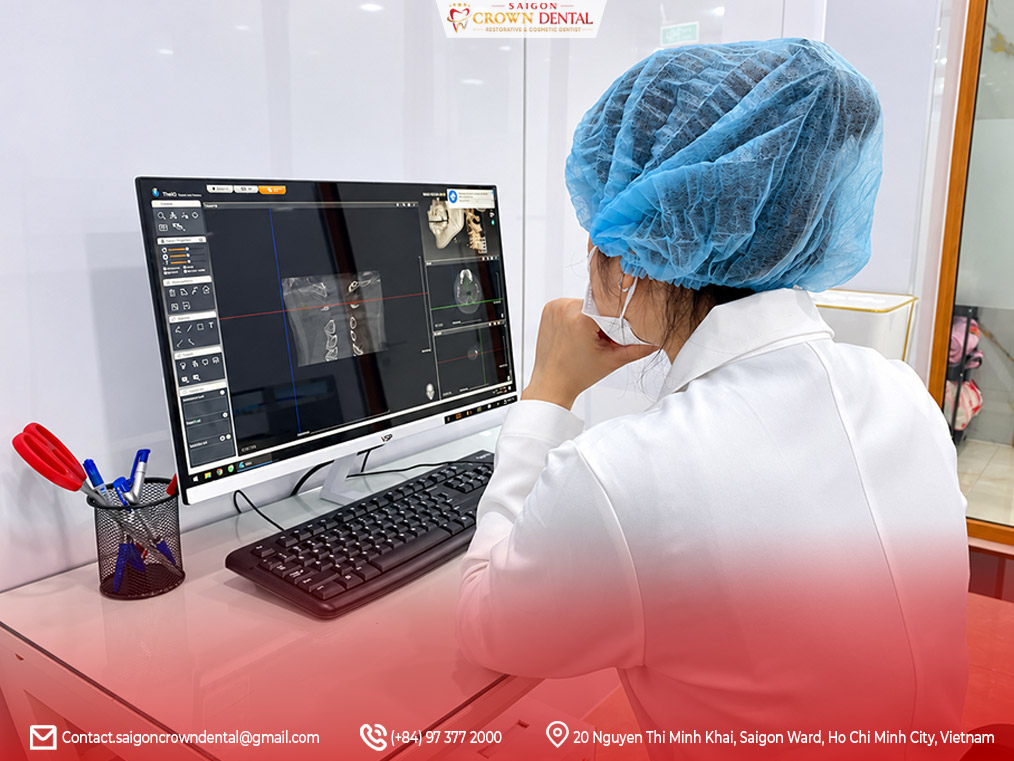 Lập kế hoạch điều trị răng sứ kỹ thuật số