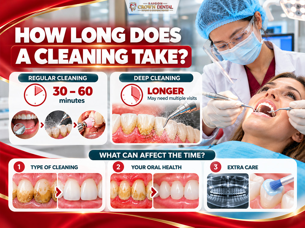 Cạo vôi răng mất bao lâu